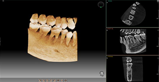 https://drsabadentalclinic.com/wp-content/uploads/2023/11/ct_scan.png