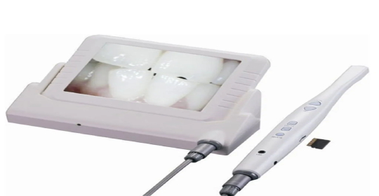 https://drsabadentalclinic.com/wp-content/uploads/2023/12/Intraoral-Camera.jpg