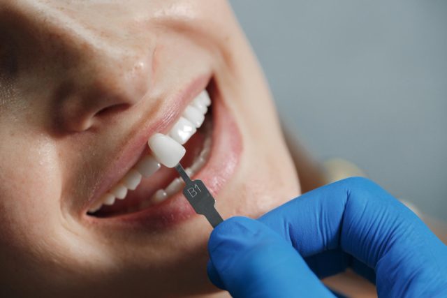 https://drsabadentalclinic.com/wp-content/uploads/2023/12/teethveneers-640x427.jpg