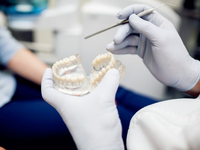 https://drsabadentalclinic.com/wp-content/uploads/2024/02/IMPLANTOVERDENTURES44-640x480.jpg