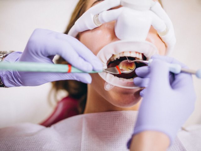 https://drsabadentalclinic.com/wp-content/uploads/2024/02/TEETHSCALLING11-640x480.jpg