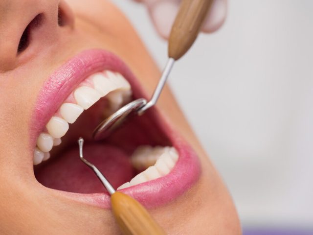 https://drsabadentalclinic.com/wp-content/uploads/2024/02/TEETHVENEERS33-640x480.jpg