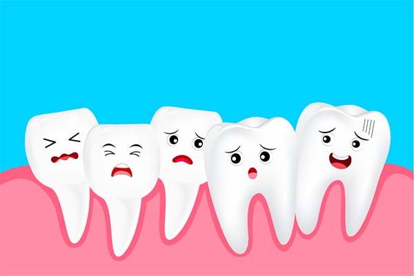 Teeth Crowding Correction